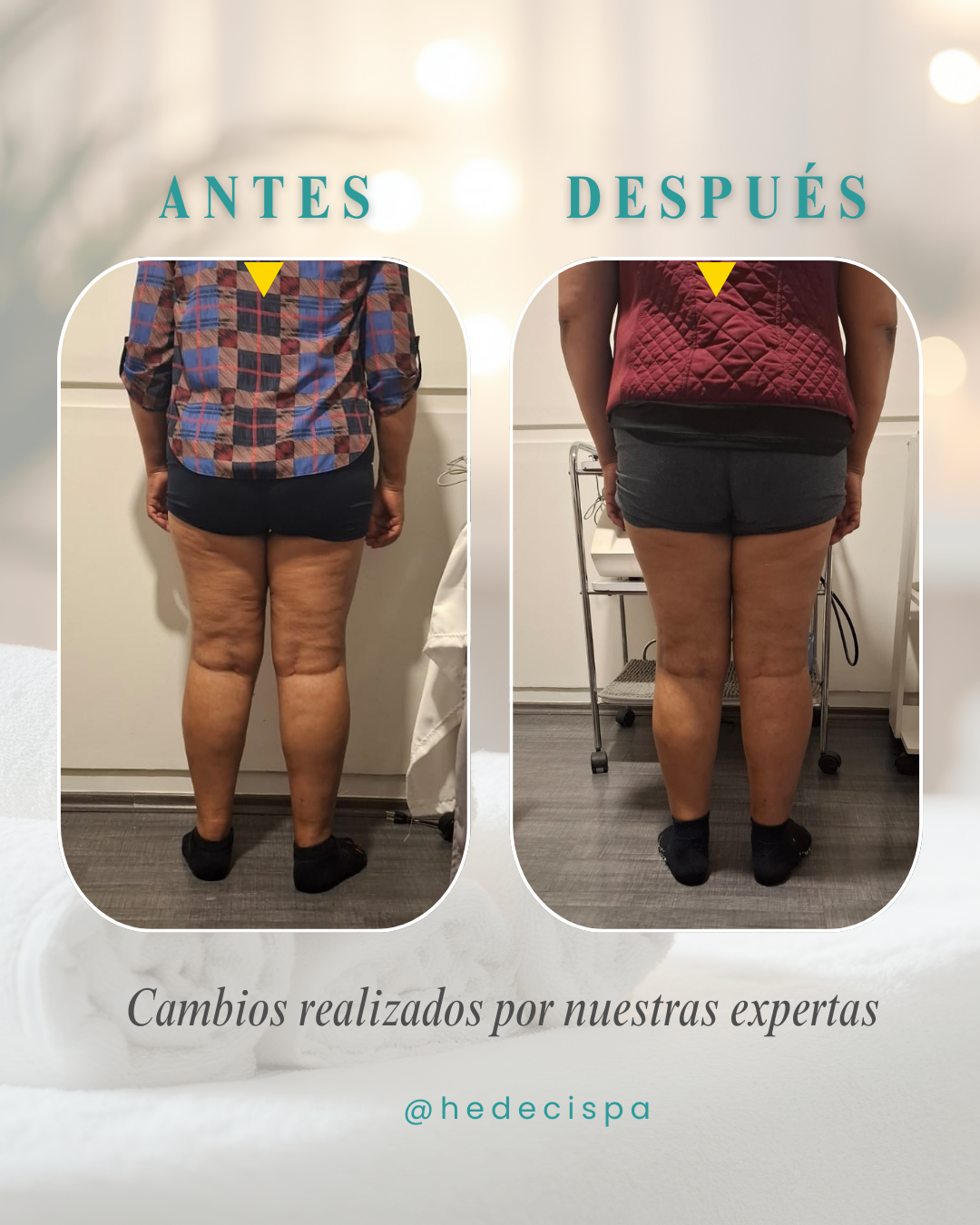 Antes y Después Corporal