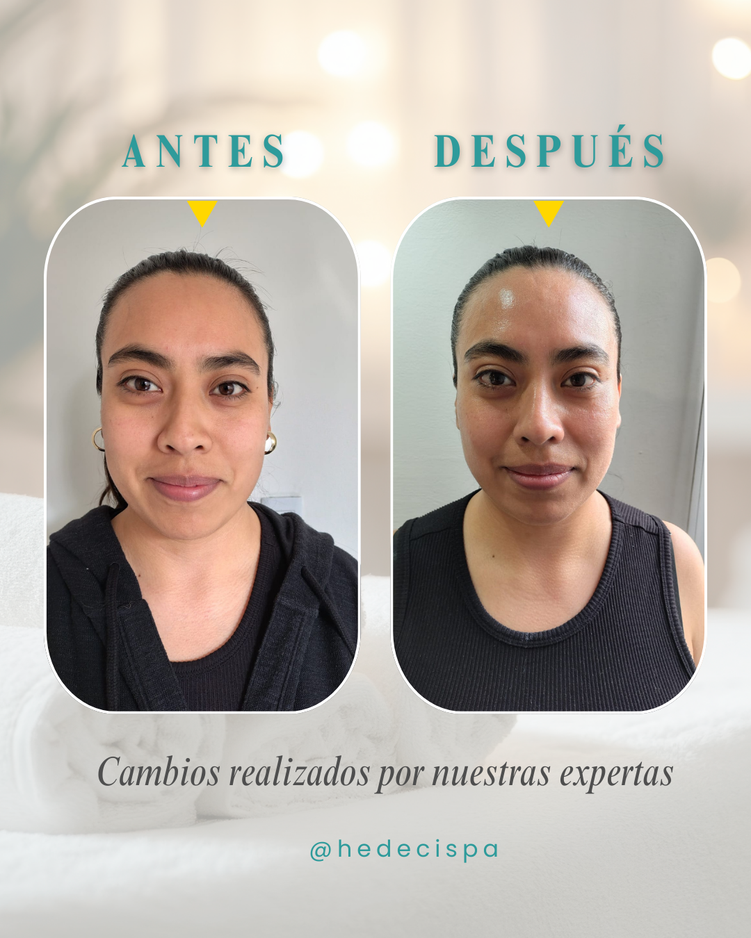 Antes y Después Facial 2